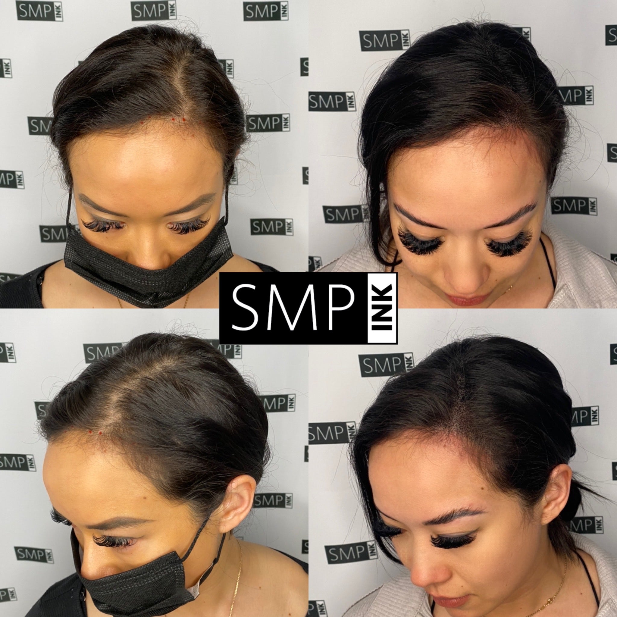 Before and after female SMP Scalp micropigmentation for Ink2Skin.